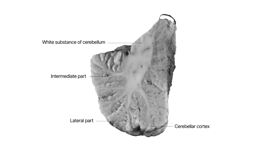 관상면(Coronal Section) - 뇌구조 | 뇌클러스터전문포털(K-Brain Net)
