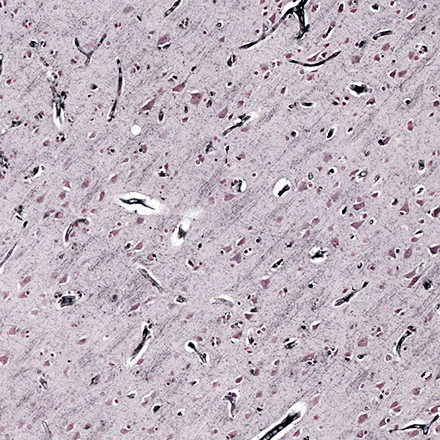 7단계 : 염색 (staining) - Gallyas silver stain protocol