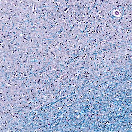 7단계 : 염색 (staining) - LFB-PAS(Luxol fast blus-Periodic acid-Schiff’s)