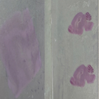 7단계 : 염색 (staining) 중 탈수 및 투명과정에 대한 두번째 단계