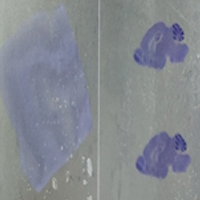 7단계 : 염색 (staining) 중 탈수 및 투명과정에 대한 세번째 단계