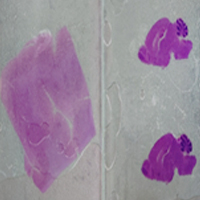 7단계 : 염색 (staining) 중 탈수 및 투명과정에 대한 네번째 단계