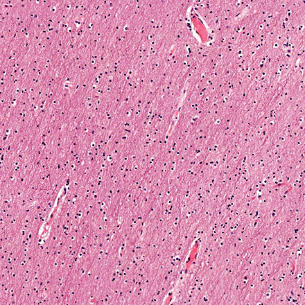 7단계 : 염색 (staining) - H&E stain protocol